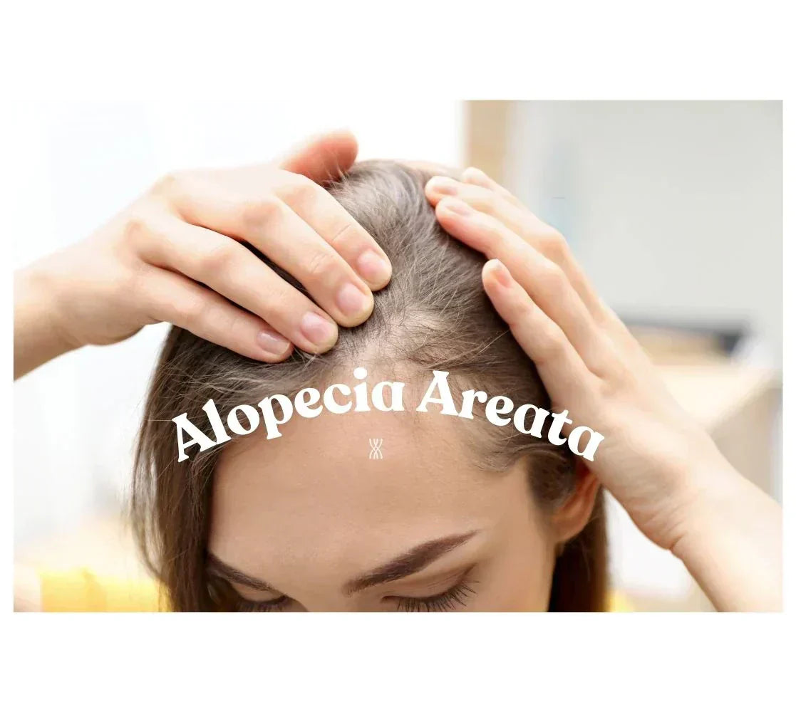 Alopecia Areata: How to Overcome It and Feel Like Yourself Again