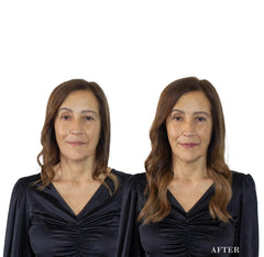 Light Brown N.6 - 35cm after. Extensões capilares removiveis e saudaveis.  Hair extensions that restore volume and confidence for women with fine or fragile hair.
Português: Extensões que devolvem volume e confiança a mulheres com cabelo fino ou frágil.